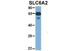 Host:  Rabbit  Target Name:  SLC6A2  Sample Type:  Human Fetal Heart  Antibody Dilution:  1.