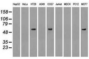 Image no. 2 for anti-Nuclear Receptor Binding Protein 1 (NRBP1) antibody (ABIN1499828) (NRBP1 anticorps)