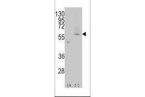 Western blot analysis of AT(Slc29a4) (arrow) using rabbit polyclonal AT(Slc29a4) Antibody (C-term) (ABIN387944 and ABIN2844505). (SLC29A4 anticorps  (AA 452-481))