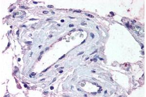 Human Testis, Vessels (formalin-fixed, paraffin-embedded) stained with ADAMTS1 antibody ABIN290128 at 13 ug/ml followed by biotinylated goat anti-rabbit IgG secondary antibody ABIN481713, alkaline phosphatase-streptavidin and chromogen. (ADAMTS1 anticorps  (Internal Region))