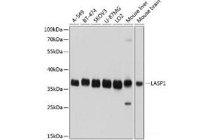 Western blot analysis of extracts of various cell lines using LASP1 Polyclonal Antibody at dilution of 1:1000.
