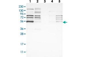 Western blot analysis of Lane 1: RT-4, Lane 2: U-251 MG, Lane 3: Human Plasma, Lane 4: Liver, Lane 5: Tonsil with WIPF2 polyclonal antibody  at 1:250-1:500 dilution. (WIPF2 anticorps)