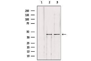 Western blot analysis of extracts from various samples, using KITH_HHV1S Antibody. (HHV-1 Thymidine Kinase anticorps)