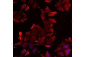 Immunofluorescence analysis of U2OS cells using PDLIM1 Polyclonal Antibody (PDLIM1 anticorps)