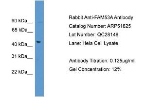 WB Suggested Anti-FAM53A  Antibody Titration: 0. (Fam53a anticorps  (C-Term))