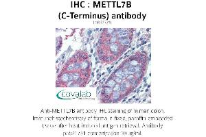 Image no. 1 for anti-Methyltransferase Like 7B (METTL7B) (C-Term) antibody (ABIN1736925) (METTL7B anticorps  (C-Term))