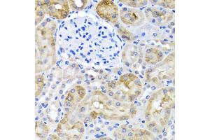 Immunohistochemistry of paraffin-embedded rat kidney using SULT1A1 antibody (ABIN5970776) at dilution of 1/100 (40x lens). (SULT1A1 anticorps)