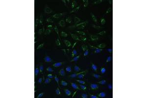 Immunofluorescence analysis of U-2 OS cells using HCCS Polyclonal Antibody (ABIN6129024, ABIN6141652, ABIN6141653 and ABIN6223386) at dilution of 1:100 (40x lens). (HCCS anticorps  (AA 1-268))