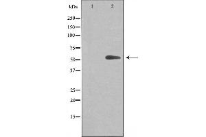 Western blot analysis of extracts from Jurkat cells, using Cytochrome P450 20A1 antibody.