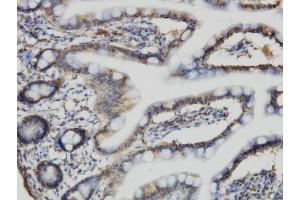 Immunoperoxidase of monoclonal antibody to ACBD3 on formalin-fixed paraffin-embedded human small Intestine.