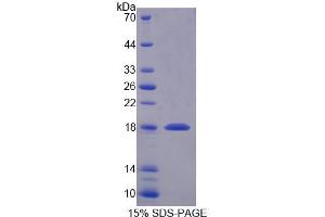 SDS-PAGE analysis of Human SNAPAP Protein. (SNAPIN Protéine)