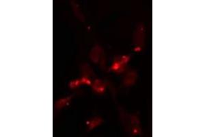 ABIN6275316 staining  NIH-3T3 cells by IF/ICC. (NUP160 anticorps  (Internal Region))