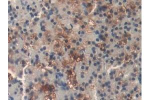 Detection of DLD in Rat Adrenal gland Tissue using Polyclonal Antibody to Dihydrolipoyl Dehydrogenase (DLD) (DLD anticorps)
