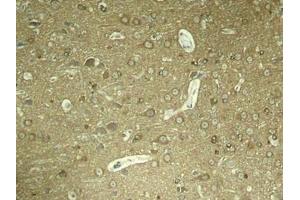 Immunohistochemical analysis of paraffin-embedded rat hippocampal region tissue from a model with Alzheimer