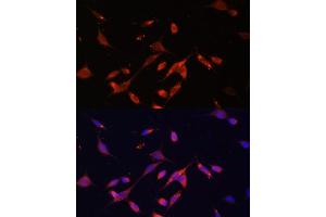 Immunofluorescence analysis of NIH/3T3 using PI3 Kinase p85 beta antibody (ABIN7269320) at dilution of 1:100. (PIK3R2 anticorps)
