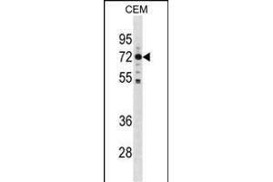 K Antibody (C-term) (ABIN1881520 and ABIN2838969) western blot analysis in CEM cell line lysates (35 μg/lane). (MAK anticorps  (C-Term))