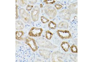 Immunohistochemistry of paraffin-embedded mouse kidney using Hsc70/HSP Rabbit pAb (ABIN3016123, ABIN3016124, ABIN3016125 and ABIN6219558) at dilution of 1:250 (40x lens).