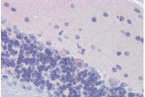 Mouse Brain, Cerebellum (formalin-fixed, paraffin-embedded) stained with GNAO1 antibody ABIN462341 followed by biotinylated goat anti-rabbit IgG secondary antibody ABIN481713, alkaline phosphatase-streptavidin and chromogen.