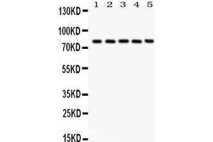 Anti- Calpain1 Picoband antibody, Western blotting All lanes: Anti Calpain1  at 0. (CAPNL1 anticorps  (AA 396-555))