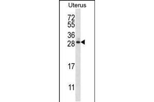Western blot analysis in human normal Uterus tissue lysates (35ug/lane). (ARL8A anticorps  (AA 82-110))