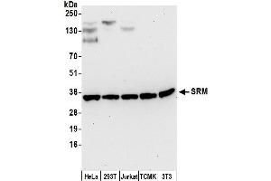 anti-Spermidine Synthase (SRM) (AA 100-150) antibody