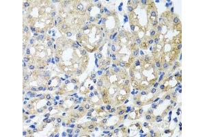 Immunohistochemistry of paraffin-embedded Mouse kidney using ST8SIA2 Polyclonal Antibody at dilution of 1:100 (40x lens). (ST8SIA2 anticorps)