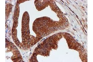 Image no. 3 for anti-Sec1 Family Domain Containing 1 (SCFD1) antibody (ABIN1500819)