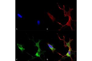 Immunocytochemistry/Immunofluorescence analysis using Mouse Anti-Cav1.
