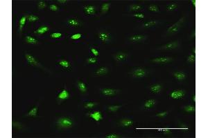 Immunofluorescence of purified MaxPab antibody to RRS1 on HeLa cell.