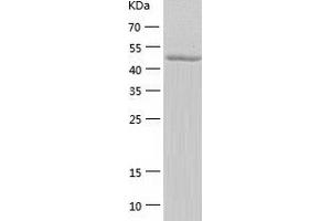 Western Blotting (WB) image for Hemopexin (HPX) (AA 24-460) protein (His-IF2DI Tag) (ABIN7123298)