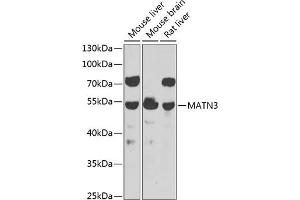 Western blot analysis of extracts of various cell lines, using M antibody  at 1:1000 dilution. (Matrilin 3 anticorps  (AA 277-486))
