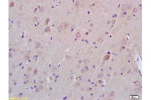 Formalin-fixed and paraffin embedded rat brain labeled with Rabbit Anti ZDHHC21 Polyclonal Antibody, Unconjugated (ABIN705566) at 1:200 followed by conjugation to the secondary antibody and DAB staining (ZDHHC21 anticorps  (AA 131-240))