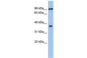Image no. 1 for anti-Radial Spoke Head 10 Homolog B (RSPH10B) (AA 287-336) antibody (ABIN6743957) (RSPH10B anticorps  (AA 287-336))