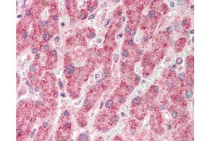 Human, Liver: Formalin-Fixed Paraffin-Embedded (FFPE).