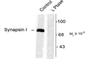 Image no. 2 for anti-Synapsin I (SYN1) (pSer603) antibody (ABIN227585) (SYN1 anticorps  (pSer603))