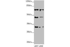 Western blot All lanes: ZNF785 antibody at 6. (ZNF785 anticorps  (AA 1-200))