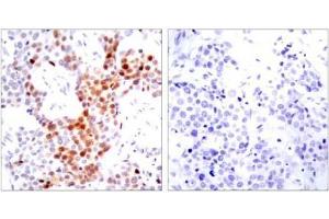 Image no. 1 for anti-Activating Transcription Factor 2 (ATF2) (pThr51), (pThr69) antibody (ABIN196664) (ATF2 anticorps  (pThr51, pThr69))