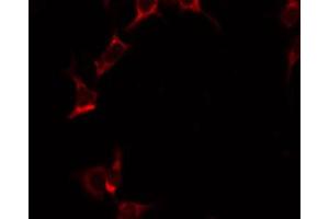 ABIN6274850 staining HeLa by IF/ICC.