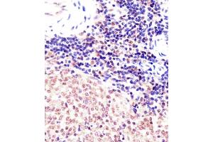 (ABIN6242141 and ABIN6578005) staining (Mouse) Suz12 in mouse spleen sections by Immunohistochemistry (IHC-P - paraformaldehyde-fixed, paraffin-embedded sections).