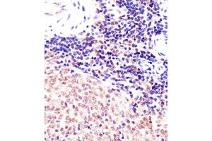 (ABIN6242141 and ABIN6578005) staining (Mouse) Suz12 in mouse spleen sections by Immunohistochemistry (IHC-P - paraformaldehyde-fixed, paraffin-embedded sections). (SUZ12 anticorps  (AA 381-395))