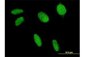 Immunofluorescence of monoclonal antibody to FLI1 on HeLa cell. (FLI1 anticorps  (AA 1-452))