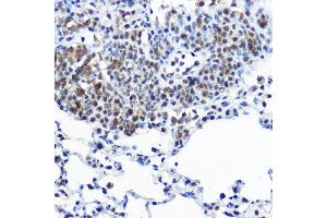 Immunohistochemistry of paraffin-embedded rat lung using Casein Kinase 2 beta (Casein Kinase 2 beta (CSNK2B)) Rabbit pAb  at dilution of 1:100 (40x lens).
