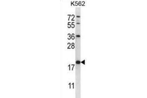 Western Blotting (WB) image for anti-Glutathione S-Transferase mu 5 (GSTM5) antibody (ABIN2996912) (GSTM5 anticorps)