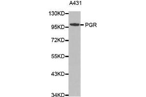 Western blot analysis of extracts of A431 cell lines, using PGR antibody. (Progesterone Receptor anticorps  (C-Term))