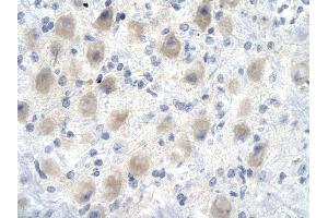 Rabbit Anti-YEATS4 antibody        Paraffin Embedded Tissue:  Human Brain cell   Cellular Data:  Epithelial cells of renal tubule  Antibody Concentration:   4. (GAS41 anticorps  (Middle Region))