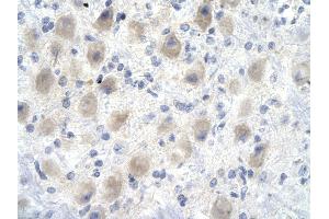 Rabbit Anti-YEATS4 antibody        Paraffin Embedded Tissue:  Human Brain cell   Cellular Data:  Epithelial cells of renal tubule  Antibody Concentration:   4. (GAS41 anticorps  (Middle Region))