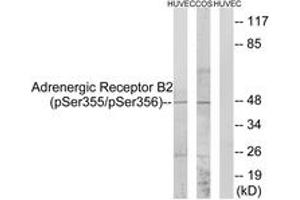 Western blot analysis of extracts from HuvEc cells treated with serum 20% 15' and COS7 cells treated with serum 20% 15', using Adrenergic Receptor B2 (Phospho-Ser355+Ser356) Antibody. (beta 2 Adrenergic Receptor anticorps  (pSer355))