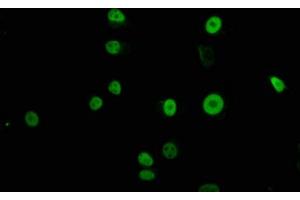 Immunofluorescence staining of MCF-7 cells with ABIN7172475 at 1:100, counter-stained with DAPI.