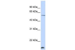 WDR40A antibody used at 1 ug/ml to detect target protein. (DCAF12 anticorps  (N-Term))