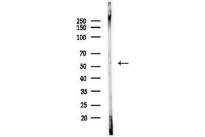 Western blot analysis of lysates from Mouse testis, using PKNOX2 Antibody at 1/1000 dilution.